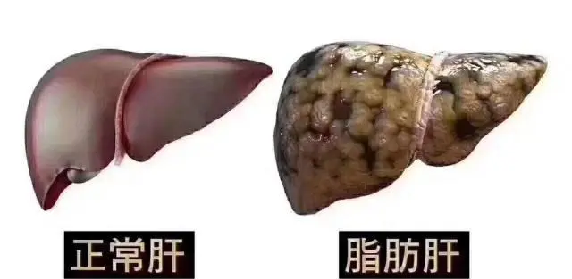 202107221102168022.png