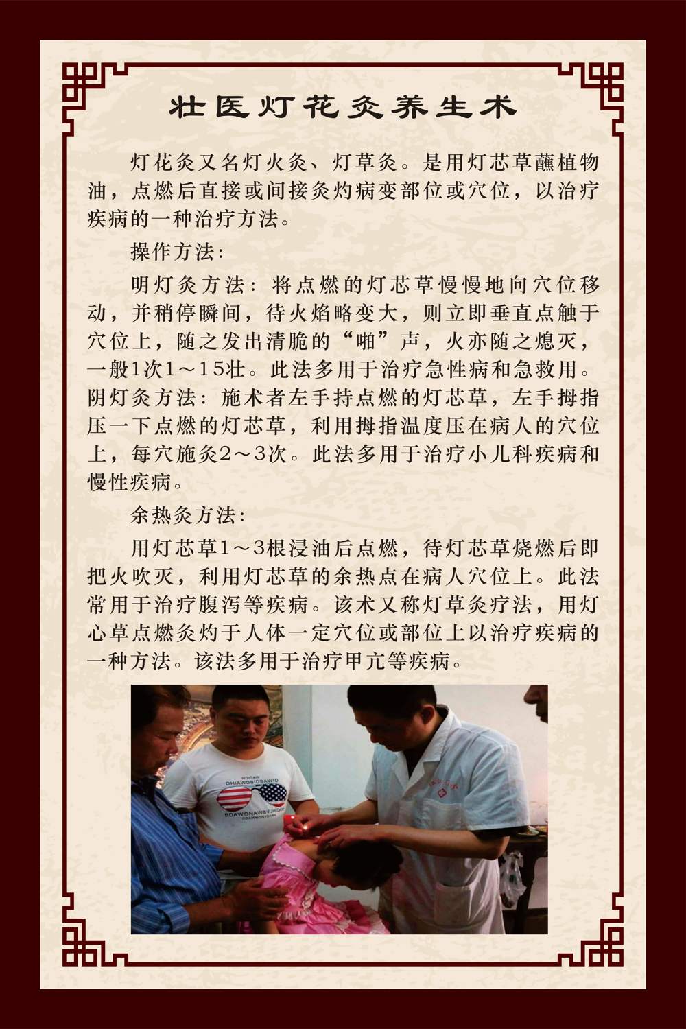 灯花灸
